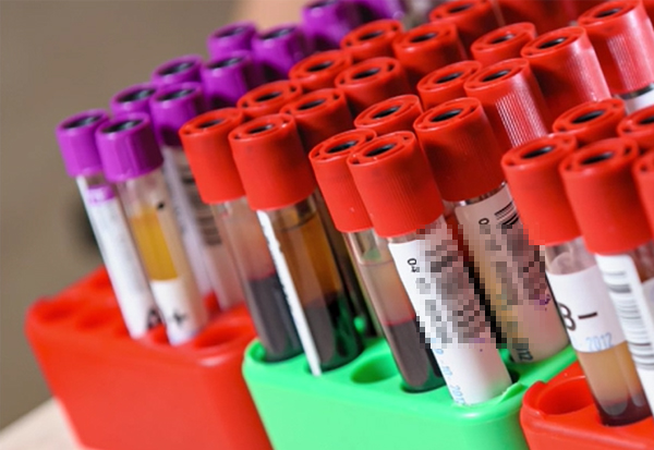 健康科普 | 抽血注意事項(xiàng)